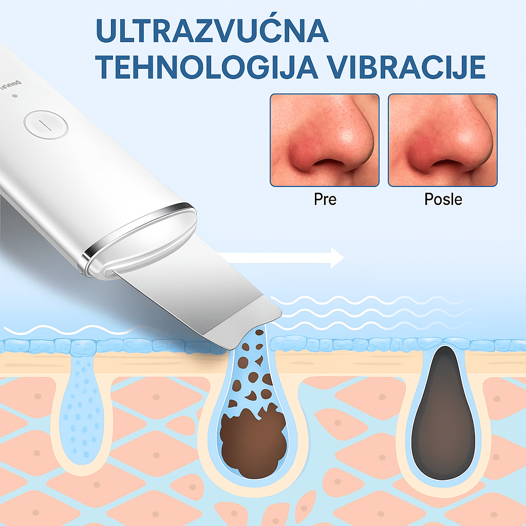 Ultrazvučna Spatula